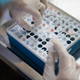 Image for article titled A Second Person in France May Have Caught Deadly Prion Disease From Lab Exposure